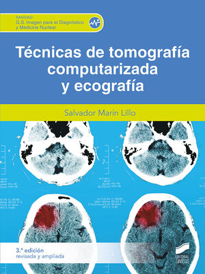 TECNICA DE TOMOGRAFIA COMPUTARIZADA Y ECOGRAFIA 3ª ED.